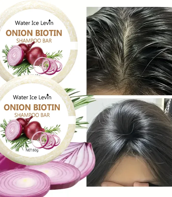 Onion and Biotin Shampoo Soap - 60g, Suitable for All Hair Types, Moisturizing and Smoothing, Rich in Rosemary Extract