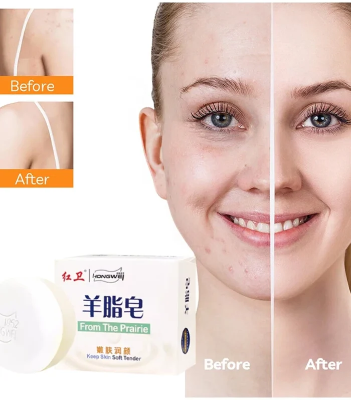 Hongwei Sheep Fat Soap 1952 Brand Natural Mild Ingredients Shampoo Face Bath Three-in-one Deep Cleansing Multifunctional Soap