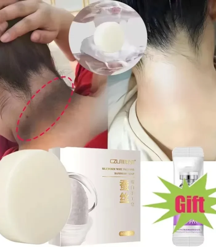 Body Whitening Soap Underarm Knee Bleaching Soap Chicken Skin Removal Dark Spot Removal Dead Skin Moisturize Brighten Body Care