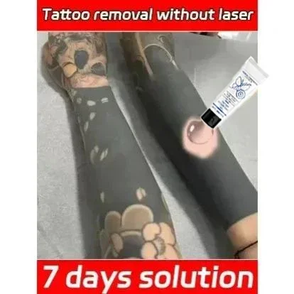 30g Tattoo Removal Gel Dissolve Tattoo Repair Skin Moisturizing Painless Deep Cleansing Care gel Feamle Makeup Product